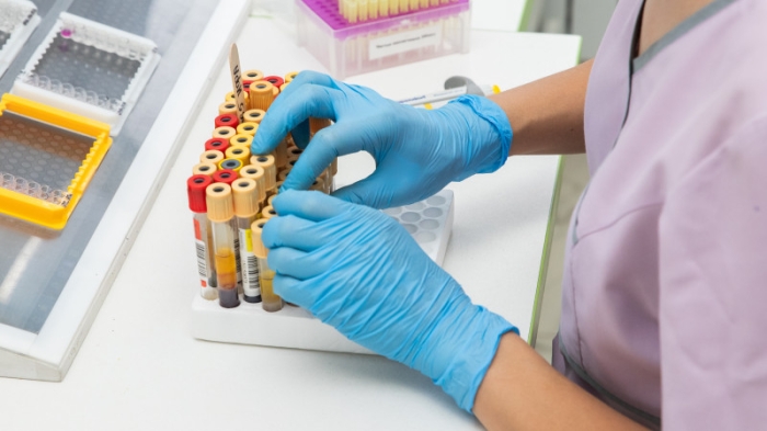 О ситуации с коронавирусом в Казахстане рассказала министр О ситуации с коронавирусом в Казахстане рассказала министр