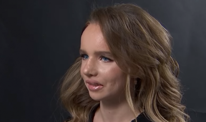 Изувеченной родными алматинке подарили новое лицо Изувеченной родными алматинке подарили новое лицо