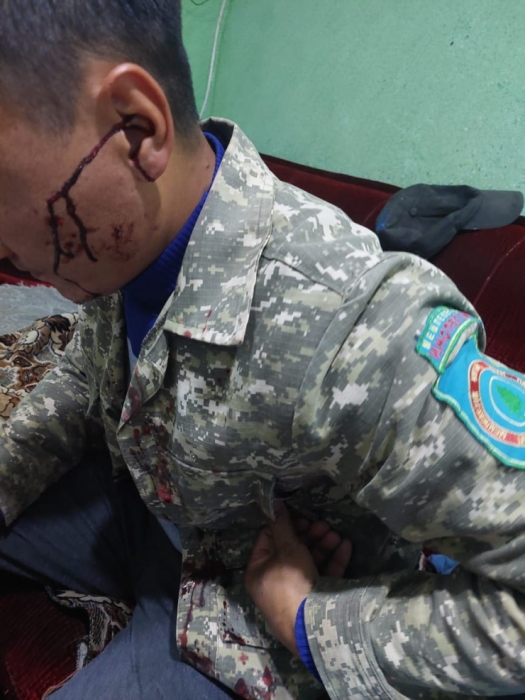 Избиение лесника в Иле-Алатауском нацпарке: в полиции прокомментировали расследование Избиение лесника в Иле-Алатауском нацпарке: в полиции прокомментировали расследование