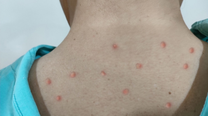 Главные новости за 27 августа: встреча с олимпийцами, строительство АЭС, вирус Мрох Главные новости за 27 августа: встреча с олимпийцами, строительство АЭС, вирус Мрох