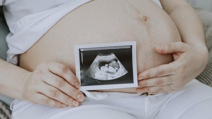 “Мозг давно умер, чего вы ждете?“ В Атырау женщина скончалась после родов, не увидев ребенка “Мозг давно умер, чего вы ждете?“ В Атырау женщина скончалась после родов, не увидев ребенка