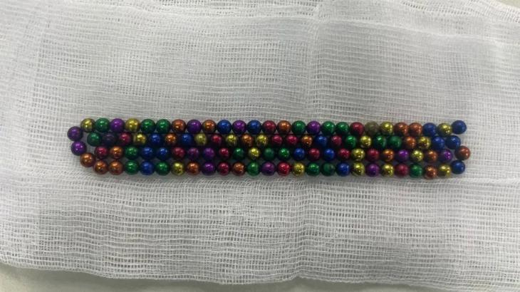 Алматыда 2 жасар баланың асқазанынан 105 магнитті моншақ алынды
Алматыда 2 жасар баланың асқазанынан 105 магнитті моншақ алынды