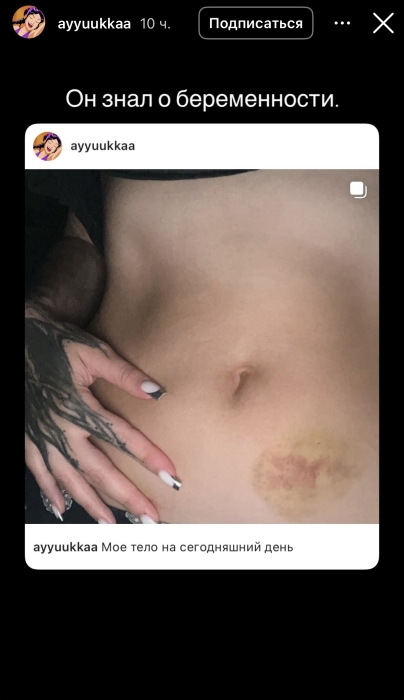 
                                                                                                                                                                                                                                                                                                                                                                                                                                                                                                "Избивал ремнём в течение часа". Жена казахстанского рэпера обвинила его в домашнем насилии
                                                            